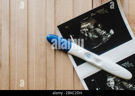 Ultraschall mit Schwangerschaftstest auf Holzhintergrund Stockfoto