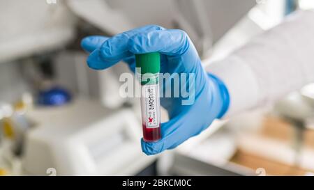 Coronavirus-Teströhrchen. Menschliche Hand in blauem Schutzhandschuh, der die Blutprobe SARS-CoV-2 hält. COVID-19 Ausbruch einer viralen Pandemie. Medizinisches Fachpersonal. Stockfoto