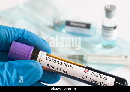 Hand-Holding-Tests Patienten Blutproben für Coronavirus Ausbruch (COVID-19) im Labor, New Coronavirus SARS-CoV-2 Stockfoto