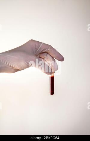 Handaufhaltefläschchen Mit Handschuhen Stockfoto