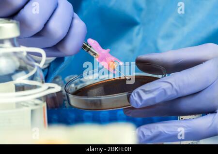 Krankenschwester bereitet Blutkultur in einer Petrischale für Experiment vorbereitet, konzeptionelles Bild Stockfoto