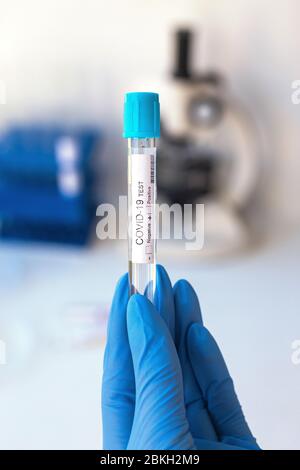 Nahaufnahme der Hand des Mikrobiologen mit chirurgischen Handschuhen, die ein positives Bluttestergebnis für Coronavirus enthalten. Stockfoto