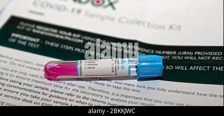 Home Testing ... Corona Virus Covid 19 Kits können an jemandes Tür geliefert werden, so dass sie sich und ihre Familie testen können, ohne das Haus zu verlassen.Home Test Kit Verfügbarkeit wird zunächst begrenzt werden, aber mehr werden verfügbar, über diese Testmethoden, Es gibt ein Netzwerk von Kurieren, die die fertigen Proben sammeln und sie sicher an die Labors liefern und das Ergebnis wird an die Einzelperson mitgeteilt. Priorisiert für Tests in England nur alle NHS und Sozialfürsorge einschließlich Ärzte, Krankenschwestern, Hebammen, Sanitäter, Sozialpersonal und alle medizinischen Mitarbeiter vor Ort. Stockfoto
