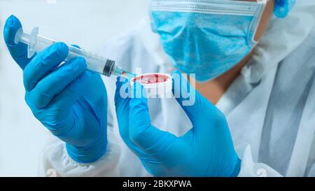 Nahaufnahme eines Arztes, der eine Maske und blaue Handschuhe trägt, die eine Spritze mit den Händen halten und eine Probe roter Flüssigkeit aus einem runden Plastikbehälter entnehmen Stockfoto