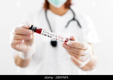Krankenschwester, die ein positives Bluttestergebnis für das neue schnell ausbreitende Coronavirus hält Stockfoto