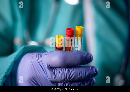 Arbeiter halten 2019-nCoV Coronavirus Teströhrchen , COVID-19, Coronavirus Epidemie Krankheit mit Arzt oder Labortechniker Wissenschaftler in PPE Personal Protec Stockfoto
