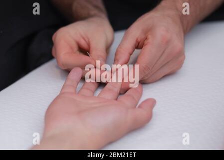 Ärzte Hand führen medizinische professionelle Akupunktur-Behandlung im Beauty-Spa auf mans Hand.Akupunktur, Akupressur mit Nadeln. Nadeln auf einem Mann s h Stockfoto