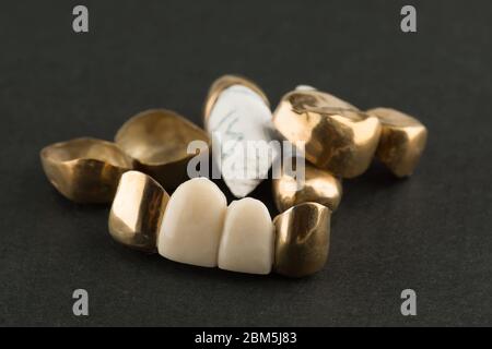 Gestanzte gelötete Zahnbrücken mit Gold auf schwarzem Hintergrund beschichtet Stockfoto