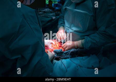 Ein chirurgisches Team führt eine chirurgische Bauchoperation durch Stockfoto