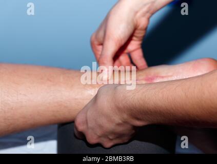 Physiotherapie-Ansicht in der Haut Stockfoto