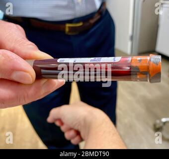 Santa Barbara, Kalifornien, USA. Mai 2020. Ein Arzt führt einen aktiven Covid 19-Test durch und bereitet sich darauf vor, die Blutflasche in ein Labor zu schicken. Quelle: Amy Katz/ZUMA Wire/Alamy Live News Stockfoto