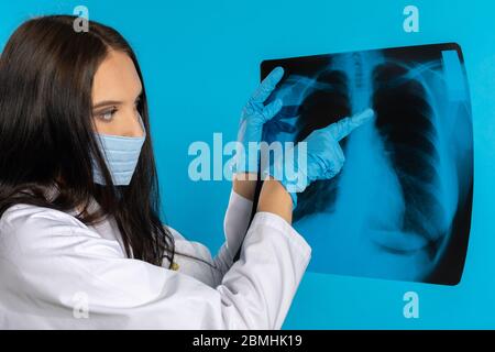 Der Arzt hat einen Verdacht auf eine Lungenröntgenaufnahme gefunden. Stockfoto