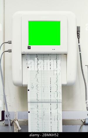 Nahaufnahme eines Fetalmonitors oder eines Non-Stress-Tests zum Drucken von Babyherzschlägen, Elektrokardiographen und Mutterkorbkontraktion im Labor- und Auslieferungsraum Stockfoto