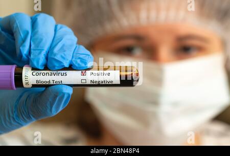 Kaukasische Frau mit medizinischer Maske und blauen Untersuchungshandschuhen, die ein Blutprobe-Röhrchen halten, das als Coronavirus-positiv gekennzeichnet ist. Stockfoto