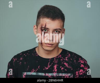 Teenager mit Wunden im Gesicht. Mobbing und Belästigung. Stockfoto