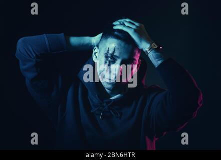 Teenager mit Wunden im Gesicht. Mobbing und Belästigung. Stockfoto