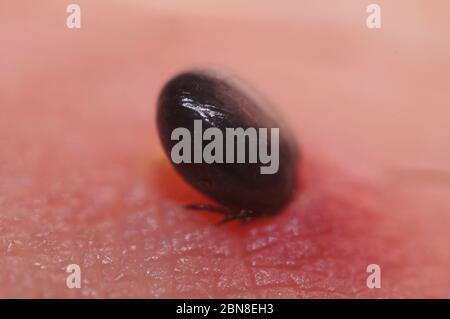 Super close up von saugenden Ixodes ricinus auf der menschlichen Haut. Erwachsene ernähren sich von großen Säugetieren wie Schafen, Rindern, Hunden, Hirschen, Menschen und Pferden für 6–13 da Stockfoto