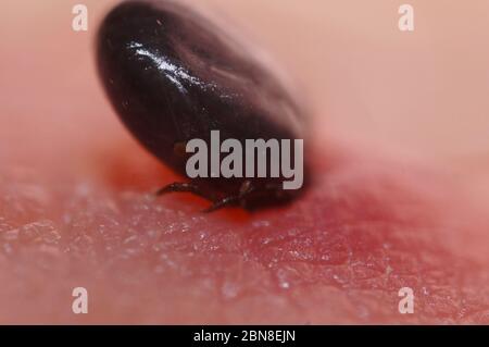 Super close up von saugenden Ixodes ricinus auf der menschlichen Haut. Erwachsene ernähren sich von großen Säugetieren wie Schafen, Rindern, Hunden, Hirschen, Menschen und Pferden für 6–13 da Stockfoto