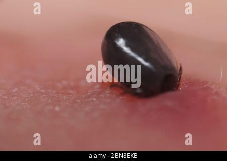 Super close up von saugenden Ixodes ricinus auf der menschlichen Haut. Erwachsene ernähren sich von großen Säugetieren wie Schafen, Rindern, Hunden, Hirschen, Menschen und Pferden für 6–13 da Stockfoto