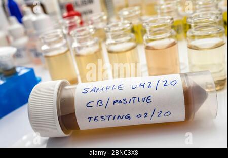 Proben mit Clostridium Botulinum Toxin kontaminiert, die Botulismus beim Menschen verursacht, Laborforschung, konzeptionelles Bild Stockfoto