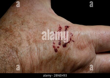 Grüne Rattennatter (Boiga cyanea) Bissspuren auf der menschlichen Hand. Giftige Arten. Stockfoto