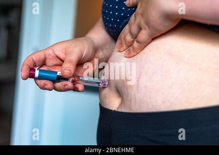Übergewichtige Frau, die Diabetes Medizin Injektion in ihren Bauch Stockfoto