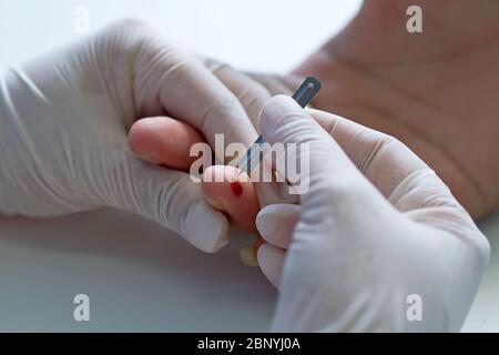 Hand des Arztes mit weißem Handschuh zeigen Blutprobe durch Blutlanze im Krankenhaus. Stockfoto