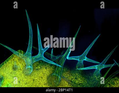 Fluoreszierend markierte Mikrofilamente in Arabidopsis-Trichomen und Epidermis-Zellen Stockfoto