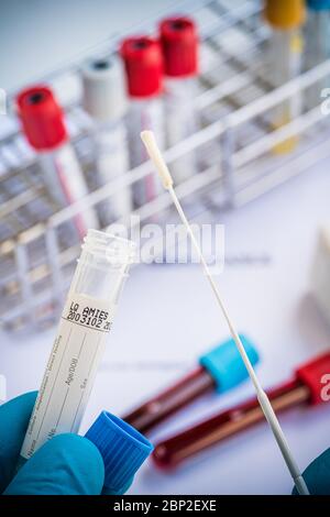 Abbildung zu den beiden Covid 19 Tests, Blutserologie und PCR. Stockfoto