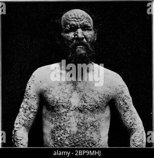 'Ein Lehrbuch über die pathogenen Bakterien und Protozoen für Medizinstudenten und Mediziner' (1916) Stockfoto