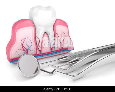 3d-Rendering von Zahn im Zahnfleisch und zahndiagnostische Instrumente auf weißem Hintergrund Stockfoto