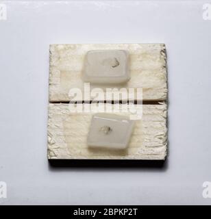 Paraffinblöcke mit Krebs Proben, Proben für die histologische Untersuchung des Tumors. Teile eines Tumors für tiefe Forschung von Krebszellen. Stockfoto