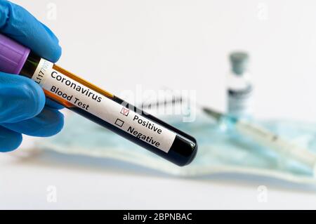 Hand-Holding-Tests Patienten Blutproben für Coronavirus Ausbruch (COVID-19) im Labor, New Coronavirus 2019-nCoV Stockfoto