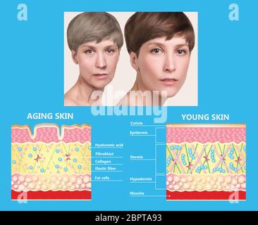 Das Diagramm der jüngere Haut und Hautalterung zeigt der Rückgang der Kollagen und Elastin in älterer Haut. Stockfoto