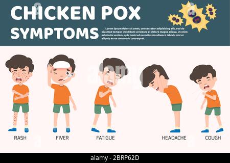 Kinder haben Windpocken Infografik, Poster Kinder Fieber und Windpocken Symptome und Prävention. Gesundheit und medizinische Cartoon Charakter Vektor Stock Vektor