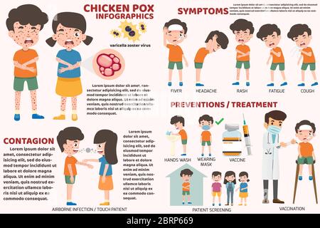 Kinder haben Windpocken Infografik, Poster Kinder Fieber und Windpocken Symptome und Prävention. Gesundheit und medizinische Cartoon Charakter Vektor Stock Vektor