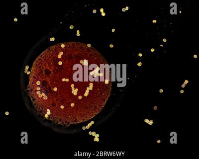 Sporen von nicht identifizierten Schimmel (auf Pfirsich gefunden), gefärbt mit Lactophenol Baumwolle blau, invertierte Hellfeld-Mikrograph, 50x Mikroskop-Objektiv Stockfoto