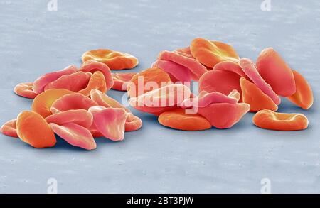 Rote Blutkörperchen. Farbige Rasterelektronenmikrograph (SEM) von roten Blutkörperchen (RBCs, Erythrozyten). Rote Blutkörperchen sind Biconhöhle, scheibenförmige Zellen, die Sauerstoff von der Lunge zu Körperzellen transportieren. Sie zirkulieren im Blut und entfernen auch Kohlendioxid in die Lunge für die Ausatmung. Ihre rote Farbe ist auf das sauerstoffführende Protein Hämoglobin zurückzuführen. Rote Blutkörperchen, die häufigste Zelle im Blut, haben keinen Kern und sind etwa 7 Mikrometer breit. Vergrößerung: 4000 bei Druck mit 10 Zentimetern Durchmesser. Stockfoto