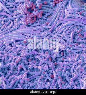 Bakterien aus einer Münze. Farbige Rasterelektronenmikrograph (SEM) von Bakterien, die von einer englischen 1-Pfund-Münze kultiviert wurden. Eine Studie, die eine zufällige Sel getestet Stockfoto