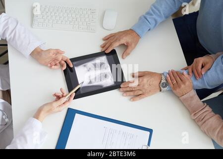 Nahaufnahme eines nicht erkennbaren älteren Paares, das der Ärztin zuhört und während der Konsultation in der Klinik das Röntgenbild der Lunge betrachtet Stockfoto