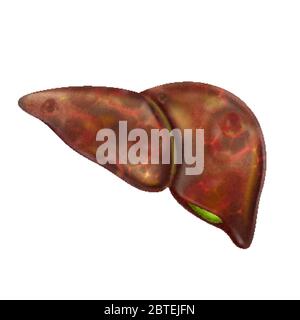 Leber Menschliche Ungesunde Krankheit Anatomie Organ Vektor Stock Vektor