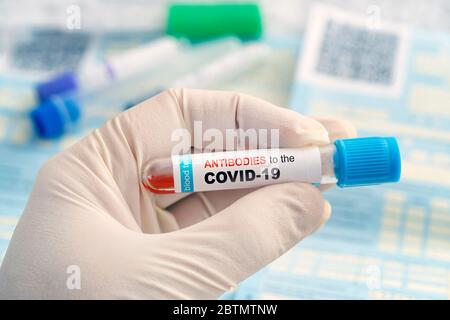 Test auf Antikörper gegen Coronavirus-Infektion. Kontrolle der Bevölkerung auf Immunität gegen covid 19. Ein Reagenzglas mit einem Bluttest in den Händen eines Arztes Stockfoto