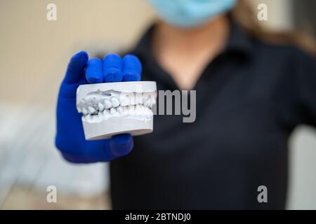 Schöne Mädchen professionelle Arzt Zahnarzt Kieferorthopäden zeigt einen Gipsdruck des Kiefers. Stockfoto