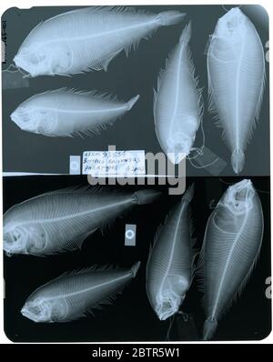 Bothus brunneus. Die Röntgenaufnahme ist von einem Paratyp; die Smithsonian NMNH Division of Fishes verwendet die Konvention, den ursprünglichen Artnamen für Typexemplare beizubehalten, die zum Zeitpunkt der Beschreibung benannt wurden. Der derzeit akzeptierte Name für diese Art ist Arnoglossus brunneus.29 Okt 2018D. 51211 Stockfoto