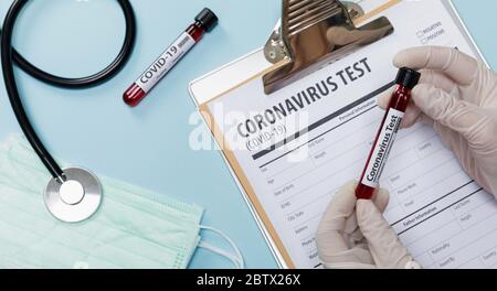 Handhaltung von Patienten Blutproben für Coronavirus Ausbruch (COVID-19) im Labor mit ärztlicher Ausrüstung, Neues Coronavirus 2019- Stockfoto