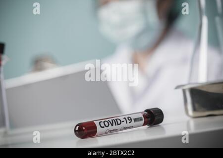Tests von Patienten Blutproben auf Coronavirus Ausbruch (COVID-19) im Labor, New Coronavirus 2019-nCoV von Wuhan China Concept Stockfoto
