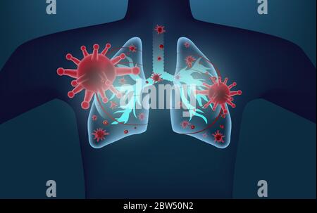 Hologramm des Coronavirus COVID-2019 auf blauem futuristischem Hintergrund. Tödliche Art von Virus 2019-nCoV. 3D-Modelle von Coronavirus Bakterienzellen-Symbol-Vektor Stock Vektor