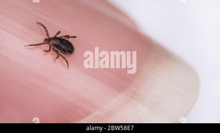 Nagel Detail mit kriechenden Hirsch Zecken Männchen. Ixodes ricinus oder scapularis. Nahaufnahme von kleiner parasitärer Milbe auf der rosa Fingerspitze des Menschen. Ekelhafter Parasit. Stockfoto