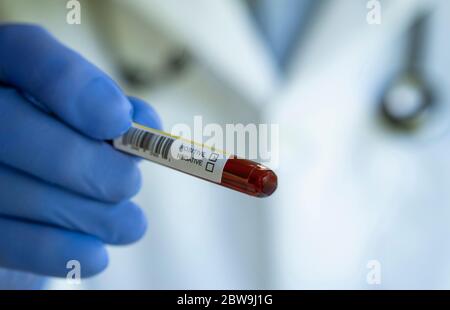 Nahaufnahme der Hand des Arztes, die die Blutprobe hält Stockfoto