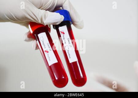 Florianópolis - SC, 29/05/2020 - testes de sangue do COVID-19.. Foto: Eduardo Valente/iShoot (Foto: Eduardo Valente/iShoot/Alamy (Upload com legenda e Stockfoto